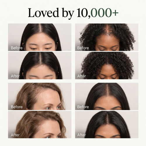 Korean Scalp Revival Bar